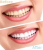 Kem đánh răng Median Dental IQ 93%