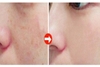 Tinh chất  Ampoule Dưỡng Sáng Da Chuyên Sâu, Mờ Đốm Sắc Tố MARTIDERM Pigment Zero DSP Bright Ampoule