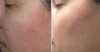 Serum The Ordinary
