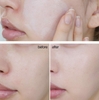 Kem chống nắng Céll Fùsion C Laser Sunscreen 100 SPF 50+PA+++