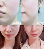 Kem dưỡng Pretty Skin 30 Days All in One Cream 100ml