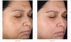 Kem dưỡng tái tạo, làm trắng,trẻ hóa, ngừa mụn Obagi Medical Retinol  Cream 28g