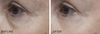 Kem dưỡng mắt dạng lăn Jm Solution Marine Luminous Pearl Deep Moisture Roll On Eye.
