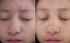 Kem vitamin K phục hồi chuyên sâu, khoẻ lớp biểu bì da Medi Shyn Stem Cell Premium Aesthetic Spa Treatment