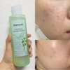 Nước hoa hồng cho da dầu mụn, nhạy cảm Mamonde Centella Trouble Toner