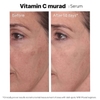 Tinh chất hỗ trợ sáng da, làm đều màu da Murad Vita-C Glycolic Serum 30ml