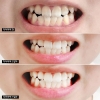 Kem đánh răng Median Dental IQ 93%