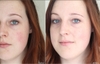 Serum Trị Nám Làm Trắng Da Caudalie Vinoperfect 30ml