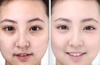 Kem trị nám tàn nhang đồi mồi Obagi Nu-Derm