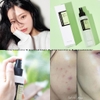 Nước Hoa Hồng Làm Dịu Da, Giảm Kích Ứng Chiết Xuất Từ Rau Má Cosrx Centella Water Alcohol-Free Toner