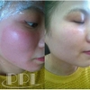 Mặt Nạ Phục Hồi Cấp Ẩm, Giảm Kích Ứng Cao Cấp Smas Peptide Silk Mask ( Cam kết hàng AUTH )