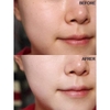 Tinh chất dưỡng trắng da Lumiderm Vital Niacinamide 20% Serum