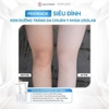Kem dưỡng body trắng da Usolab Medical Dermatology Bio Intensive Light Cream