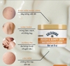 Kem Dưỡng Trị Thâm Mông, Nách, Bẹn Gold Bond Rough & Bumpy Skin Cream 226g