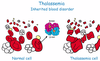 Thalassemia (Tan máu bẩm sinh): Nguyên nhân, triệu chứng, chẩn đoán và điều trị