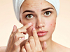 Cách chăm sóc da mặt khi bị mụn