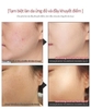 PHẤN NƯỚC ELDAS EG TOX AMPOULE CUSHION