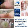 DUNG DICH TRỊ MỤN CÓC,MẮC CÁ CHÂN DUOFILM 15 ML (Pháp)