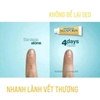 SET KEM TRỊ PHỎNG NEOSPORIN ORIGINAL- 1TUBE 28.3g + 2TUBES 14.2g