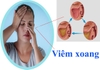 Bệnh viêm mũi-xoang và những điều cần biết