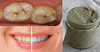 Làm Đẹp Với Đất Sét
