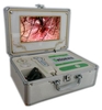 MÁY SOI DA TÓC MÀN HÌNH LCD RADIUM BD-328