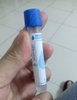 Ống đựng máu xét nghiệm