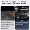 Bồn ngâm chân, kiêm máy massage chân tự động. Thương hiệu Hà Lan cao cấp Philips - PPM5104F