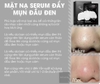 Review Serum Đẩy Mụn Đầu Đen Goodbye Blackhead