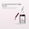 Tinh Chất So’Natural Red Peel Tingle Serum