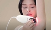 Máy triệt lông tmrbae xịn, mịn, xinh bằng tia Laser tại nhà.