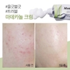 Kem dưỡng phục hồi da mụn Missha Near Skin Madecanol Cream