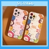 Ốp Best Friend cam lồi trong