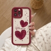 Ốp Love Mềm Chống Sốc