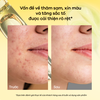 Serum Tinh Chất Dưỡng Sáng Da, Chống Lão Hóa, Mờ Thâm Nám Đa Tầng Anodin 10X Goldnexamic Serum 30ml