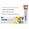 Kem giảm mụn, giảm thâm ACNEDERM Azelaic Aicd 20% Acne Derm 20g