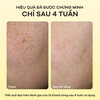 Kem Dưỡng Sáng, Mờ Thâm Nám Đa Tầng, Chống Lão Hóa Anodin 10X Goldnexamic Hàn Quốc 35ml