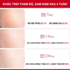Kem Dưỡng Mờ Thâm Nám Chuyên Sâu Angel's Liquid Tranexamic Mela Cream 50ml