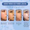 Serum giảm mụn OMUSE chứa Retinol 0.3% giảm thâm mụn và kiềm dầu - Blemish Solution Acne Correcting Serum 30ml