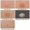 Miếng dán mụn Ciracle Red Spot Acne Pimple Path 24 Miếng