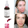 Serum Peel Da Tái Tạo Da The Ordinary AHA 30% + BHA 2% Peeling Solution 30ml