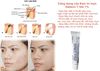 Kem trị mụn Dalacin T gel 1%  Nhật Bản (10g)