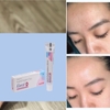 Gel trị mụn Klenzit MS Klenzit C giảm mụn sưng viêm, mụn ẩn, mụn đầu đen , giảm thâm Glenmark 15g