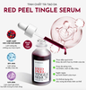 Tinh chất tẩy da chết hóa học So Natural Red Peel Tingle Serum 10ml