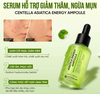 c220 - Serum giảm mụn Kyung Lab Acnes Centella Asiatica Ampoule 50ml