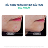 F504 - BIODERMA - Tinh Chất Sáng Mịn, Mờ Thâm Bioderma Sébium Serum Cải Thiện Toàn Diện Da Dầu Mụn 30ml