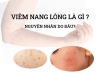 Viêm nang lông là gì? Nguyên nhân bị viêm nang lông mùa 