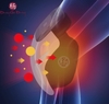 may-massage-tri-lieu-khop-goi-dgd68p