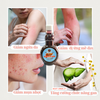 Thanh Huyết Mát Gan Vĩnh Quang - Giảm Ngứa Dị Ứng Mề Đay - Tăng cường Chức Năng Gan Chai 280ml
