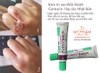 kem-tri-seo-gentacin-10g-nhat-ban-cuu-tinh-cua-moi-loai-seo
